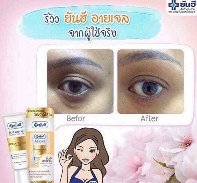 GEL TRỊ QUẦNG THÂM MẮT VÀ XOÁ TAN CÁC VẾT NHĂN MẮT YANHEE