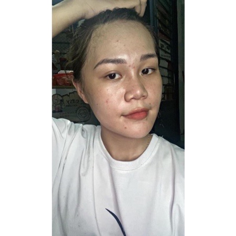 Serum sạch mụn Dr Mai 5ml, lựa chọn hoàn hảo cho làn da mụn | BigBuy360 - bigbuy360.vn