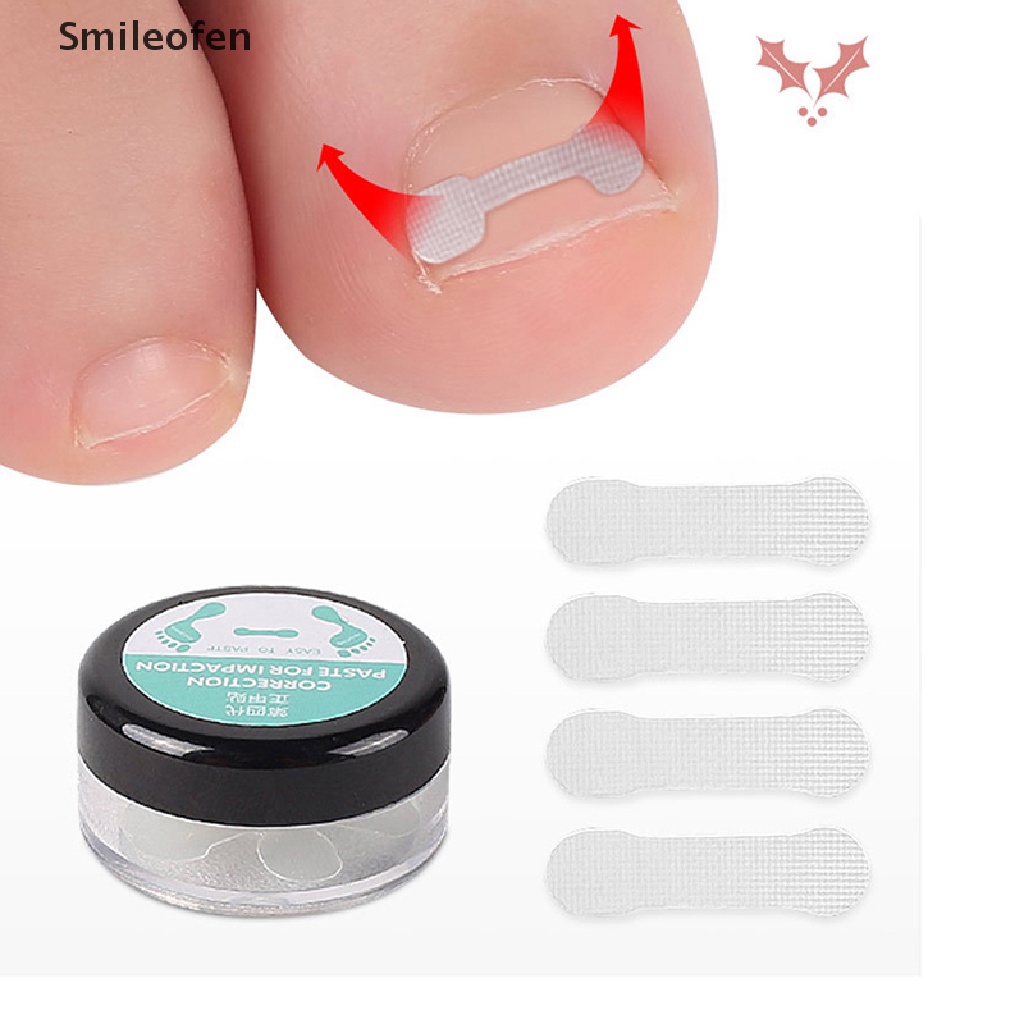 Set 10 Miếng Dán Chỉnh Sửa Móng Chân Mọc Ngược