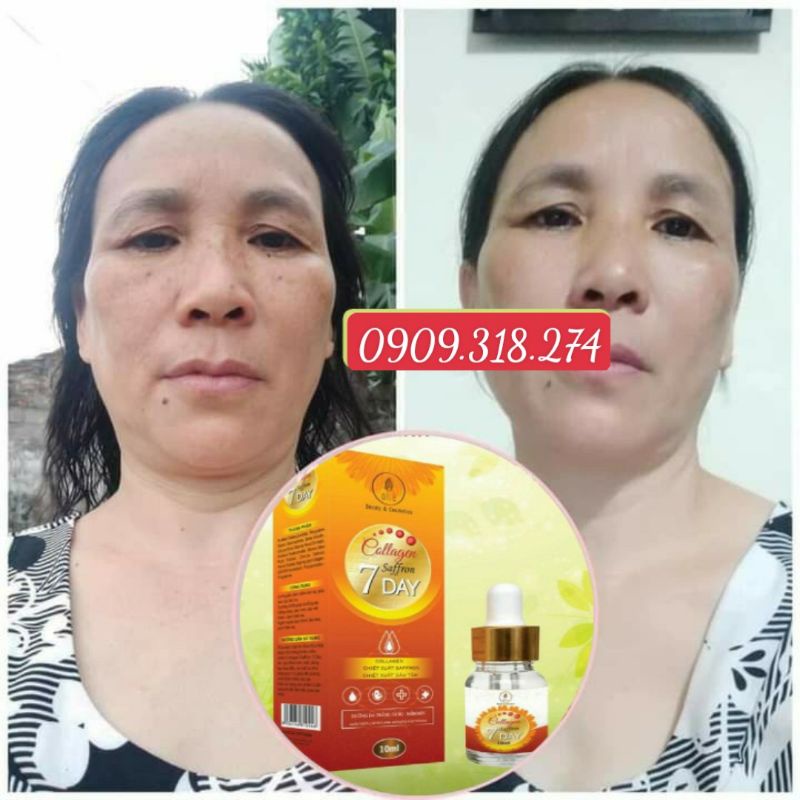 [CHÍNH HÃNG] SERUM COLLAGEN SAFFRON OLIC - kèm phiếu bảo hành