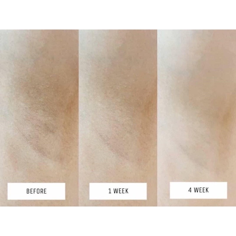 SERUM VASELINE TRẮNG NÁCH MẪU MỚI THÁI LAN