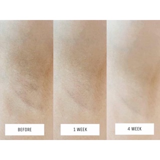 SERUM VASELINE TRẮNG NÁCH MẪU MỚI THÁI LAN