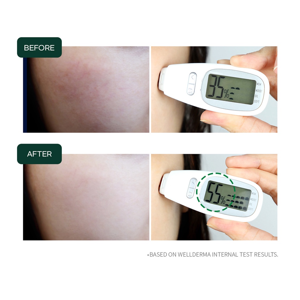 Bộ huyết thanh serum Cica và con lăn Wellderma v-line mini Cica Beauty Care Serum & Roller Set