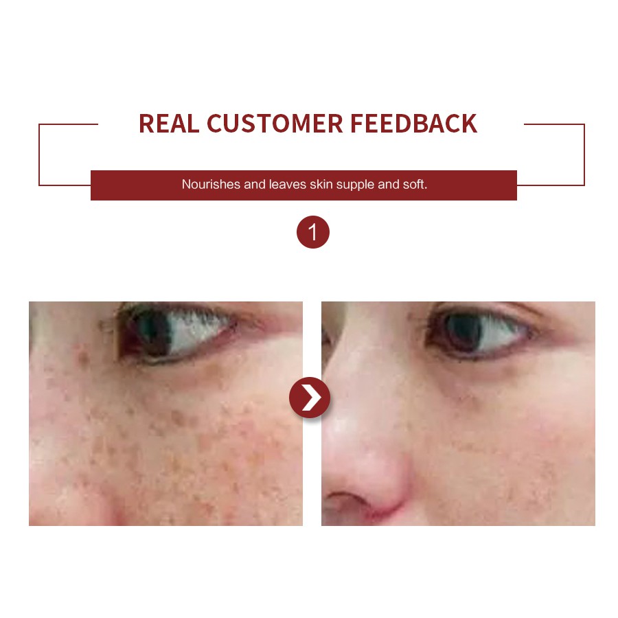 Tinh Chất peptide 100% Nguyên Chất 100ml Chống Nếp Nhăn Dưỡng Ẩm Làm Săn Chắc Da Mặt