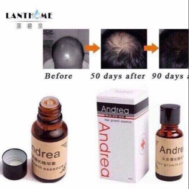 Serum kích mọc tóc Andrea