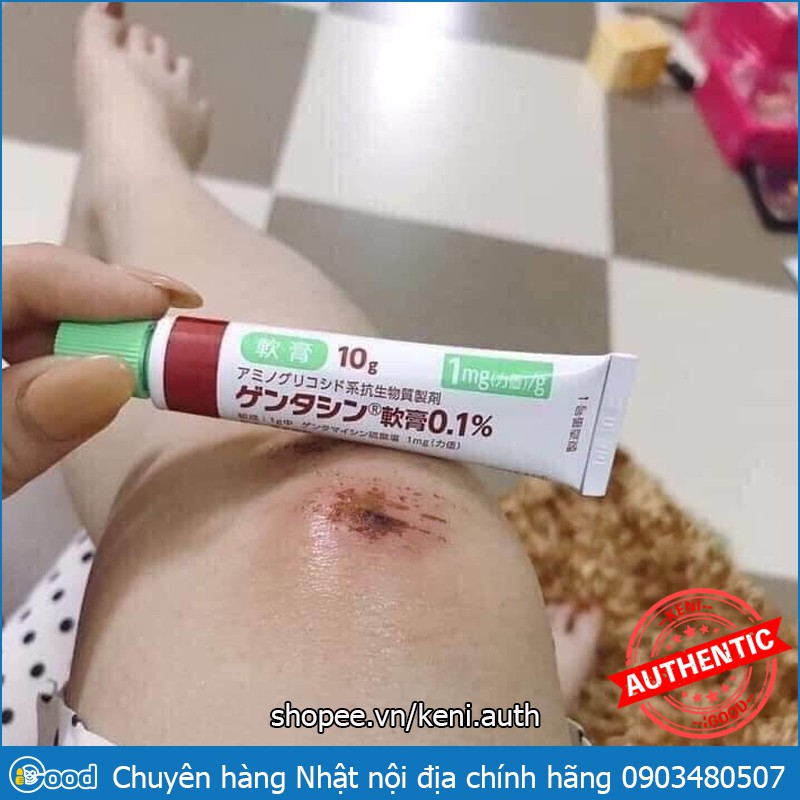 Kem giảm sẹo Gentacin Nhật Bản 10g | BigBuy360 - bigbuy360.vn