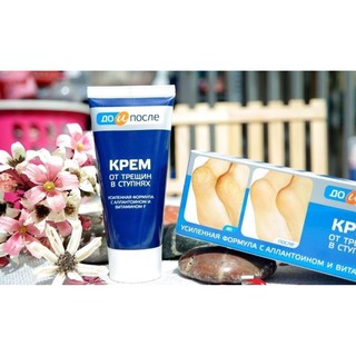 Kem trị nứt gót chân Nga Kpem