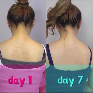 Xịt mụn lưng - the magic clear body mist