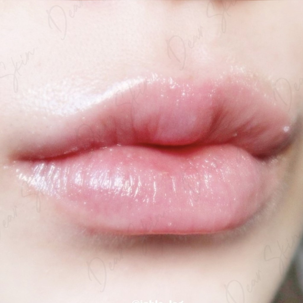 [Chính Hãng] [Mediheal] Son Dưỡng Môi Làm Mờ Sắc Tố, Mềm Môi Mediheal Labocare Panteno Lips màu đỏ