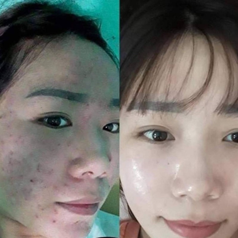 Bột Rửa Mặt Thảo Mộc Thiên Nhiên - Bột Đắp Mặt Thảo Mộc Thiên Nhiên