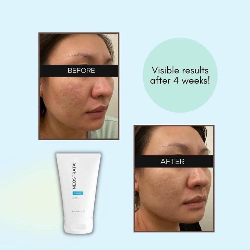 Gel Dưỡng Neostrata Refine Gel Plus Set Up Level 15 AHA 125ml