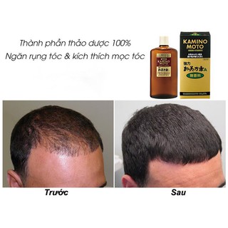 SERUM DƯỠNG TÓC NGĂN RỤNG TÓC KÍCH THÍCH MỌC TÓC KAMINOMOTO NHẬT BẢN 200ML