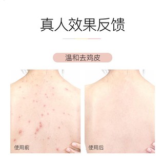 [SẴN] Muối tắm giảm mụn Anfany