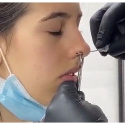 Kẹp xỏ khuyên mũi - Kẹp dẫn hướng