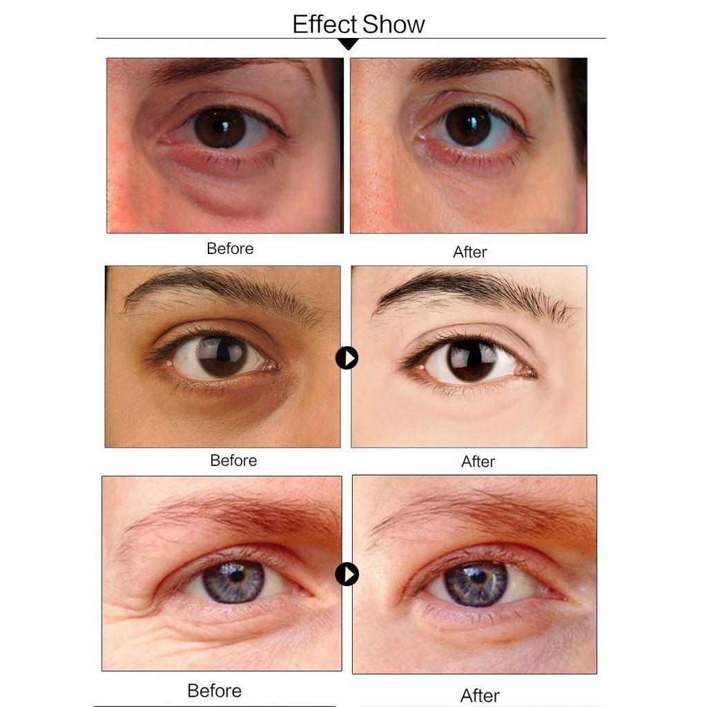 [Hàng mới về] Mặt nạ mắt tinh chất collagen vàng chất lượng cao | BigBuy360 - bigbuy360.vn