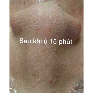 Dung dịch ủ mụn YOUNGERC