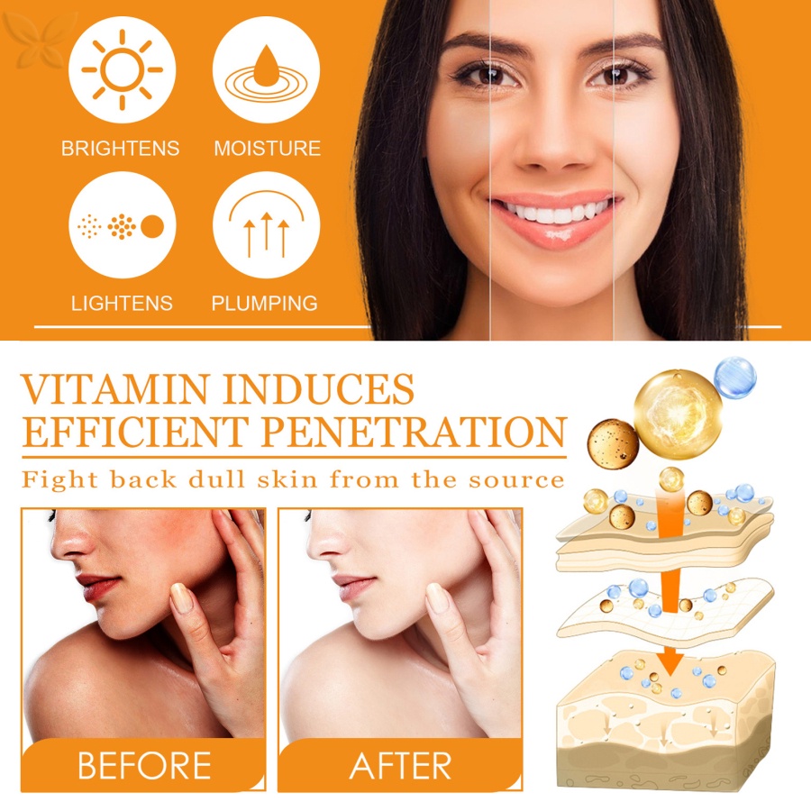[VOG] Tinh Chất Vitamin C 10ml Dưỡng Ẩm Làm Trắng Xóa Đốm Nâu Cấp Nước Kiềm Dầu Cho Da