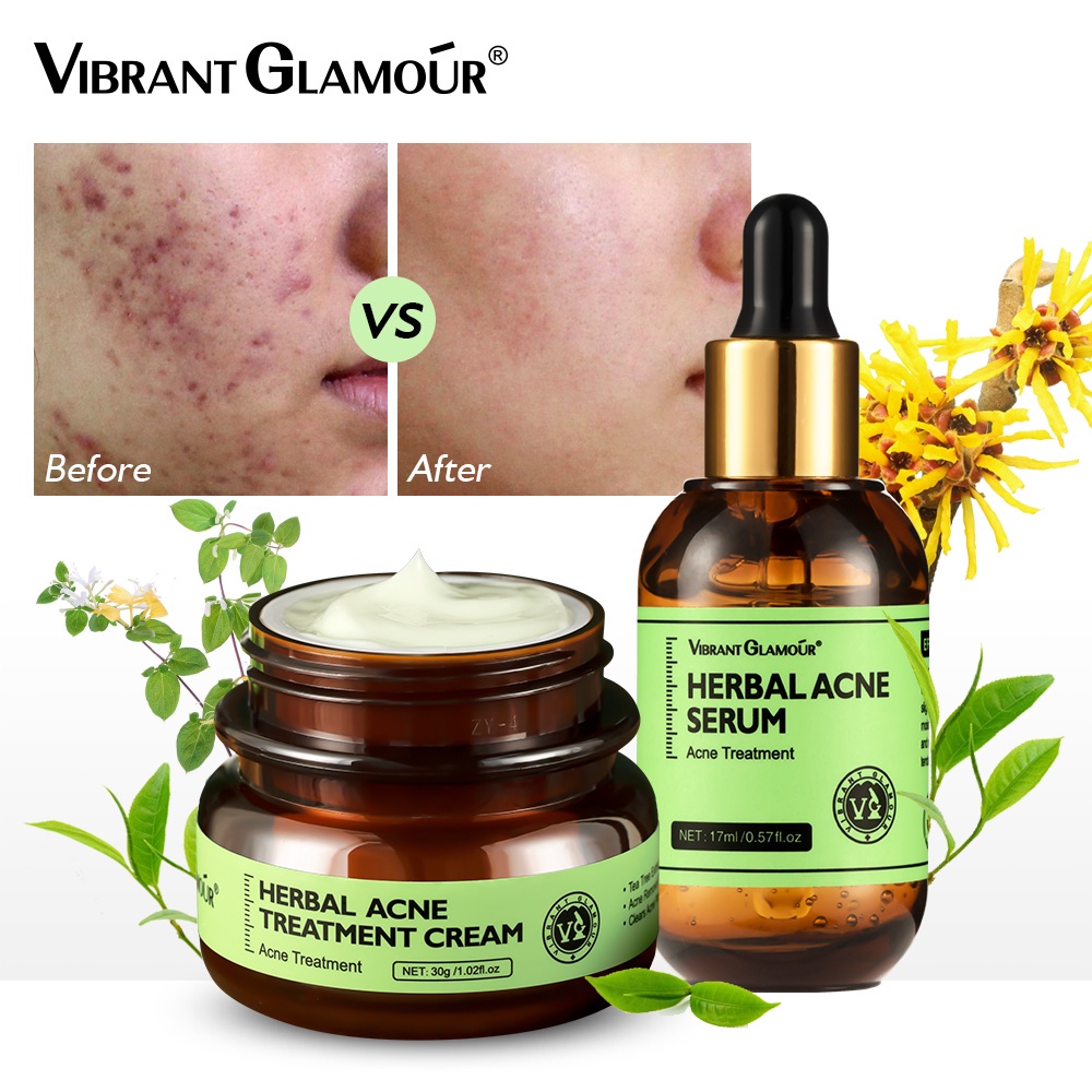 Bộ 2 sản phẩm chăm sóc da mặt VIBRANT GLAMOUR hỗ trợ làm giảm mụn chăm sóc da