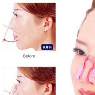Dụng cụ kẹp nâng mũi