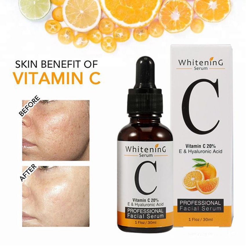 Tinh Chất Vitamin C 30ml Chống Lão Hóa Dưỡng Ẩm Làm Trắng Sáng Da Kiềm Dầu Chống Oxy Hóa Se Khít Lỗ Chân Lông