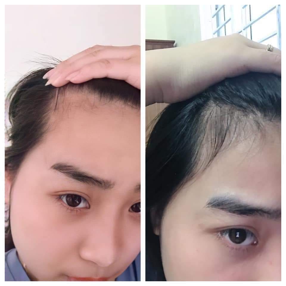 Dr.Hair Zenpali Dài Mi, Dầy Mày, Kích Mọc Tóc | BigBuy360 - bigbuy360.vn