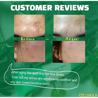 Kem Chấm Mụn Cellmula Ac Clear Spot