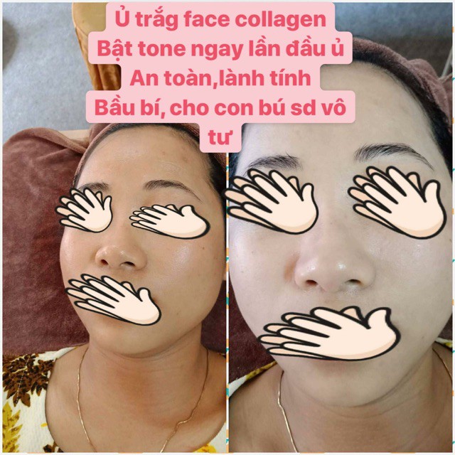 [SP Chính Hãng] Ủ TRẮNG MẶT HUYẾT YẾN COLLAGEN ( hàng chuyên dùng trong spa) | BigBuy360 - bigbuy360.vn