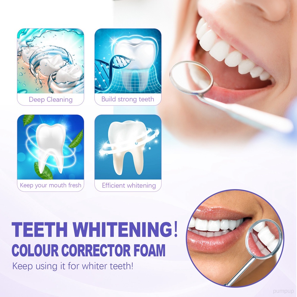 Tuýp Kem Đánh Răng V34 45ml Làm Trắng Loại Bỏ Vết Bẩn Thoáng Khí Màu Sắc Tươi Tắn