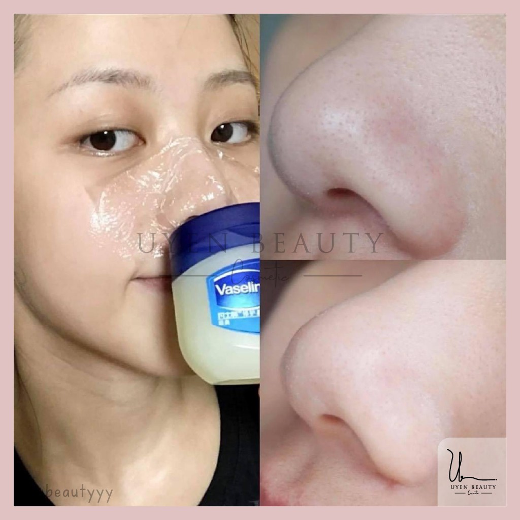 [Chính Hãng - Kèm Bill] Sáp Dưỡng Đa Năng Vaseline - 100g