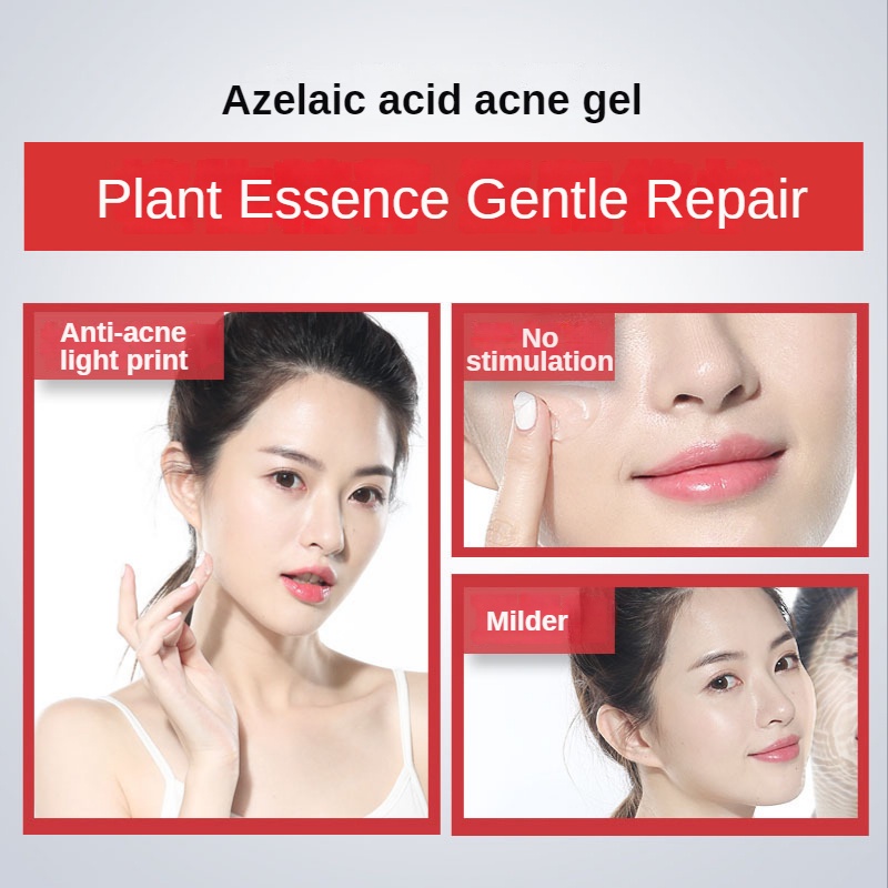 Gel Axit Azelaic 15% Làm Sáng Da Hỗ Trợ Giảm Mụn 15g