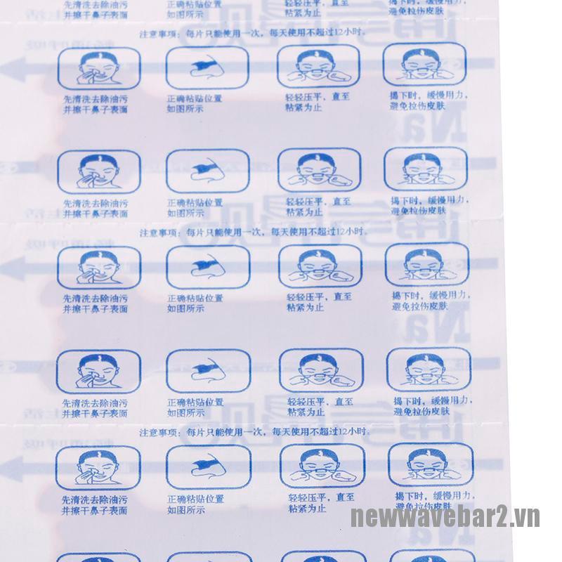 Bộ 50 Dụng Cụ Chống Ngáy Thoáng Khí Thoải Mái