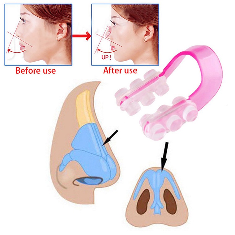 Kẹp mũi, dụng cụ thu gọn cánh mũi, nâng sống mũi, kẹp mũi làm đẹp, dụng cụ chỉnh sửa khuôn mặt
