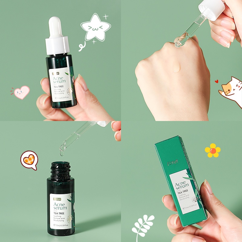 Serum tràm trà FENYI kiềm dầu chống mụn làm dịu da 17ml