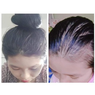 COMBO CHĂM SÓC TÓC THẢO MỘC MẸ KEN