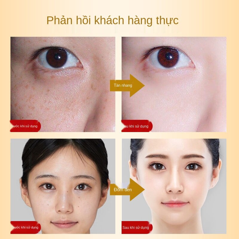 Hàng Chính Hãng Kem Làm Trắng Da Loại Bỏ Nám Chấm Vết Tàn Nhang Đồi Mồi Sắc Tố Melanin Sinh Viên Thảo Dược Của Y Học Cổ 