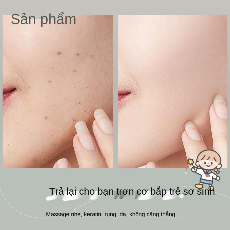 Tẩy tế bào chết gel, da mặt, nam và nữ, toàn thân, chết, gà, mụn đầu đen, kho báu bùn thoa trị