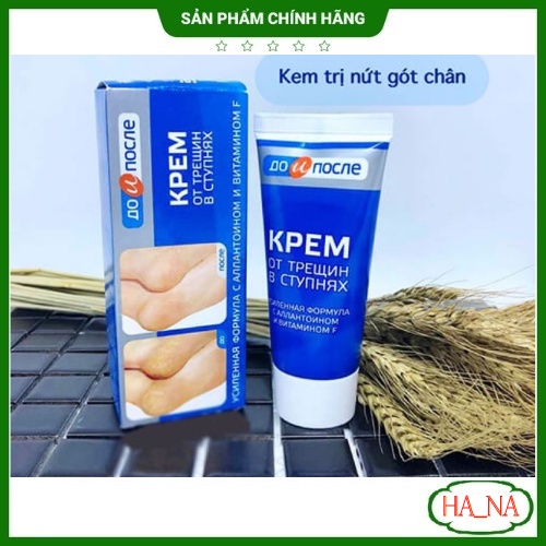 Kem bôi Nứt Gót Chân, Kem  Hồi Phục Nứt Nẻ Gót Chân Kpem Nga 50ml - Dưỡng Ẩm Và Làm Mềm Gót Chân Hiệu Quả