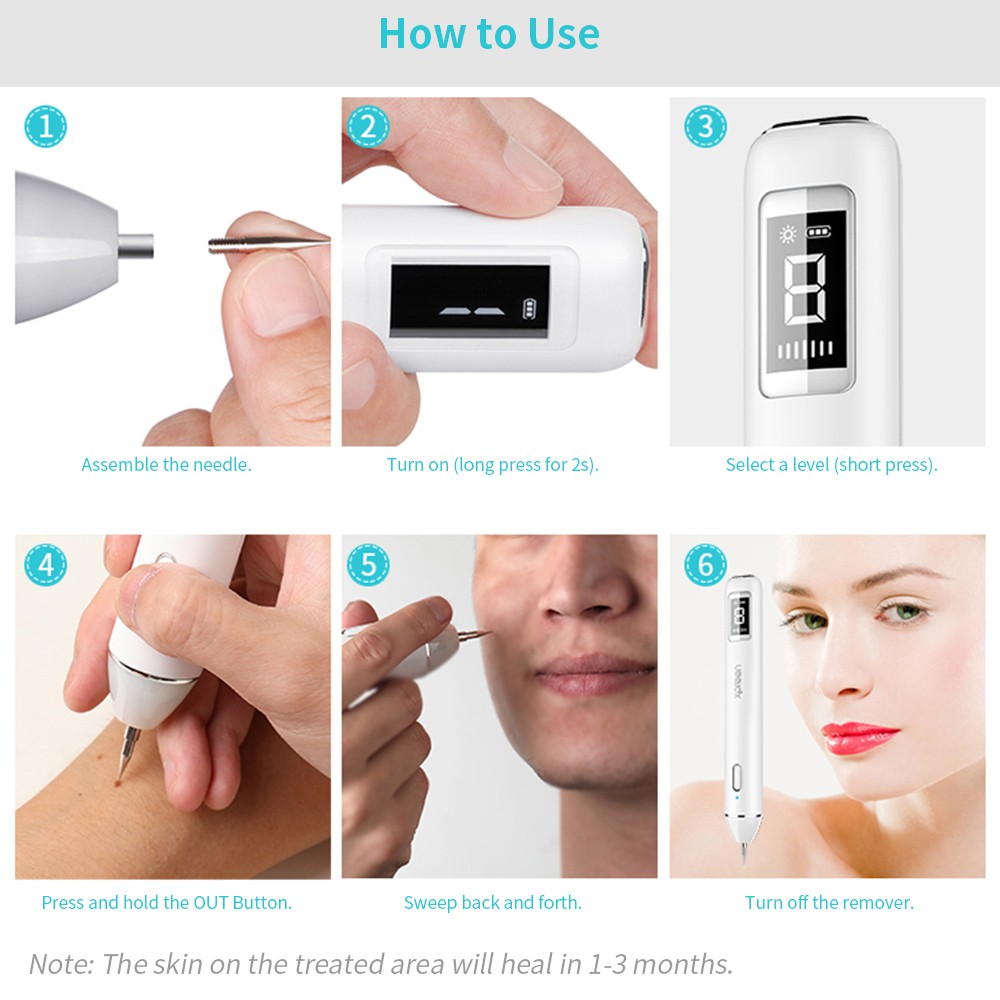 Bút plasma xóa nốt mụn / tẩy hình xăm chất lượng