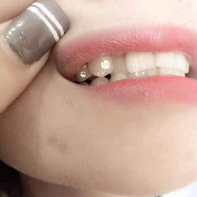 Combo 20 viên đá đính răng kèm keo