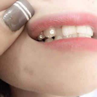 Combo 20 viên đá đính răng kèm keo