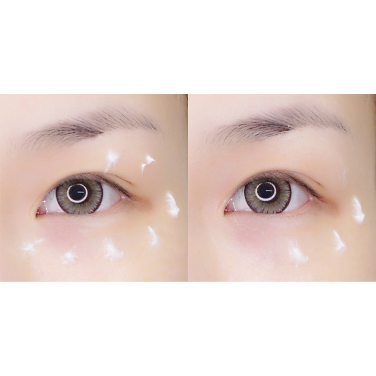 Kem Mắt Nọc Rắn Balance Active Formula Snake Venom Eye Cream | BigBuy360 - bigbuy360.vn