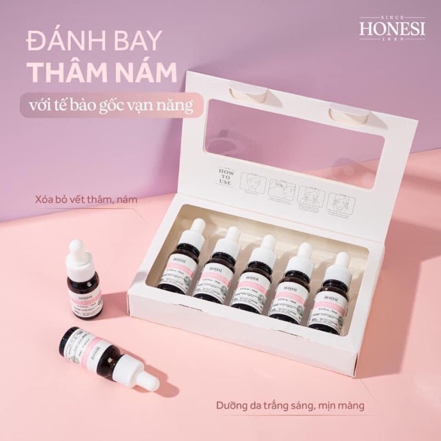 Serum-Tế bào gốc huỷ nám Honesi