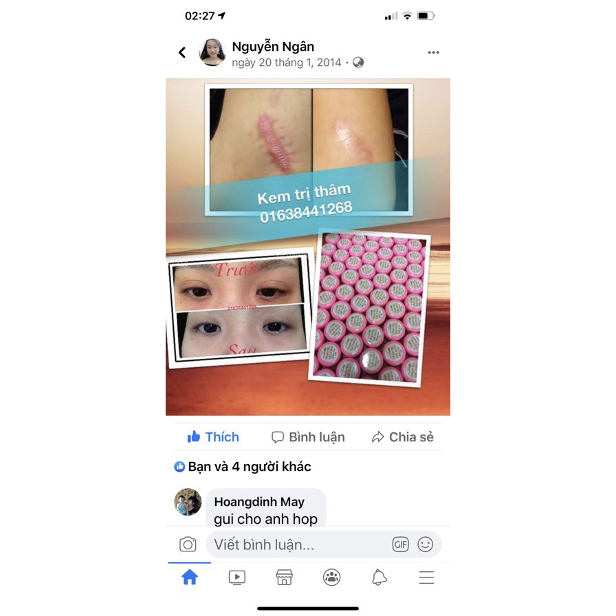 (Mẫu mới 25gr) Kem thâm dầu cá, mờ vết thâm mụn, thâm muỗi.... hàng mới nhất | BigBuy360 - bigbuy360.vn