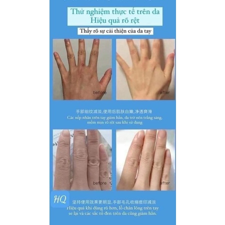 Serum dưỡng trắng làm mềm da tay, chống nhăn chống lão hoa YINBA