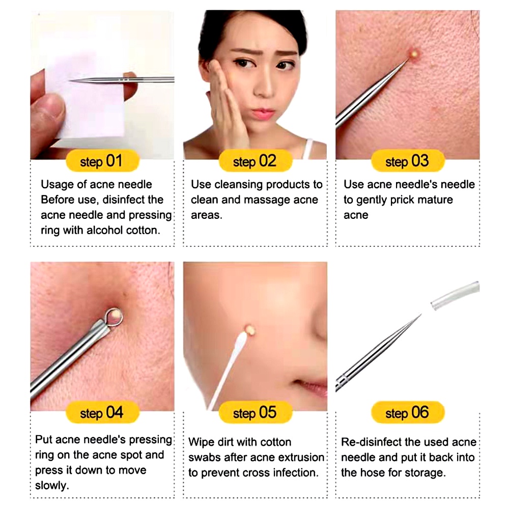 Set 4 Dụng Cụ Loại Bỏ Mụn Đầu Đen Chăm Sóc Da Mặt Tiện Dụng