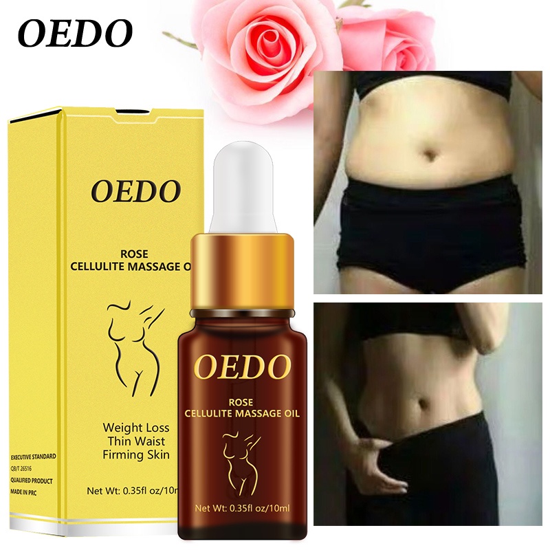 Kem massage giảm béo OEDO 10ml đốt mỡ thừa vùng bụng/ đùi/ bắp tay/ bắp chân làm thon gọn săn chắc da