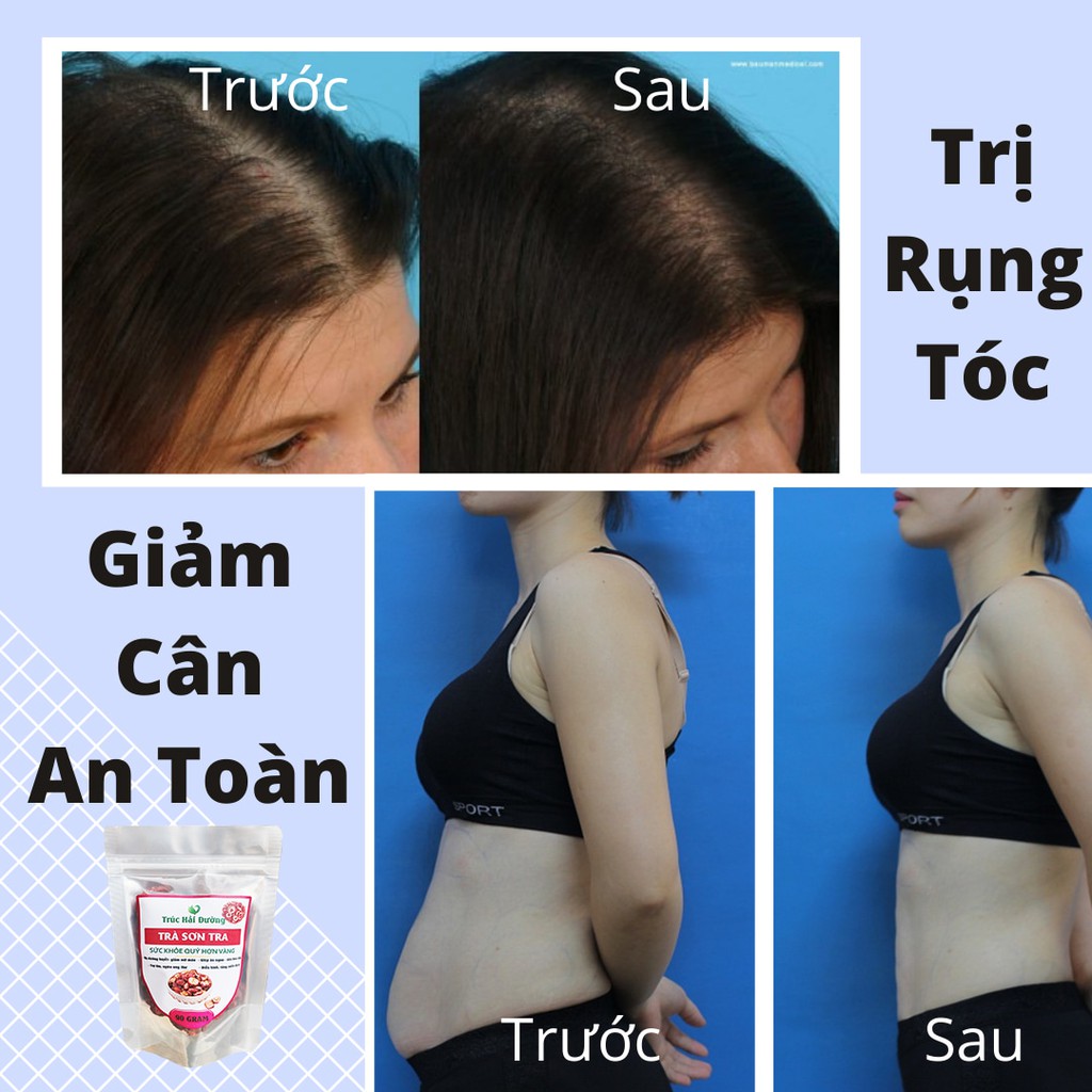 [CHÍNH HÃNG]Trà Sơn Tra Giảm Cân, Tiêu Mỡ, Chống Rụng Tóc Pha Trà Hoa Cúc, Kim Ngân Hoa Ngừa Nám, Ngừa Mụn, Thanh Nhiệt