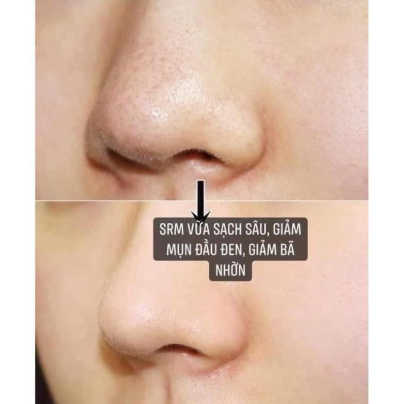 Sữa rửa mặt Aron vitamin E Thái Lan, sữa rửa mặt ngừa mụn sạch nhờn hiệu quả | BigBuy360 - bigbuy360.vn