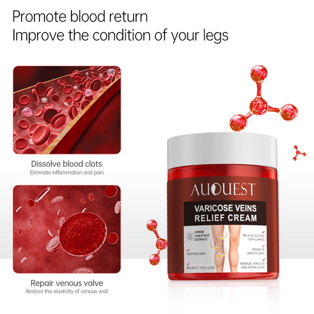 Kem Chiết Xuất Từ Gừng Tự Nhiên 80g Giúp Giảm Giãn Tĩnh Mạch Hiệu Quả