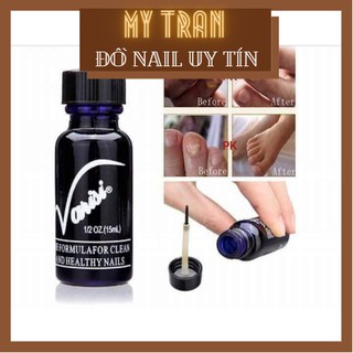 Varisi Loại bỏ nấm móng tay, nấm móng Chân